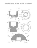 Joint Prosthesis with Positionable Head diagram and image