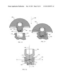 Joint Prosthesis with Positionable Head diagram and image