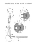 Joint Prosthesis with Positionable Head diagram and image