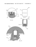 Joint Prosthesis with Positionable Head diagram and image