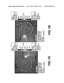 IN VIVO AND EX VIVO GENE TRANSFER INTO RENAL TISSUE USING GUTLESS     ADENOVIRUS VECTORS diagram and image