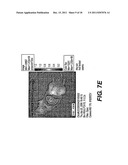 IN VIVO AND EX VIVO GENE TRANSFER INTO RENAL TISSUE USING GUTLESS     ADENOVIRUS VECTORS diagram and image