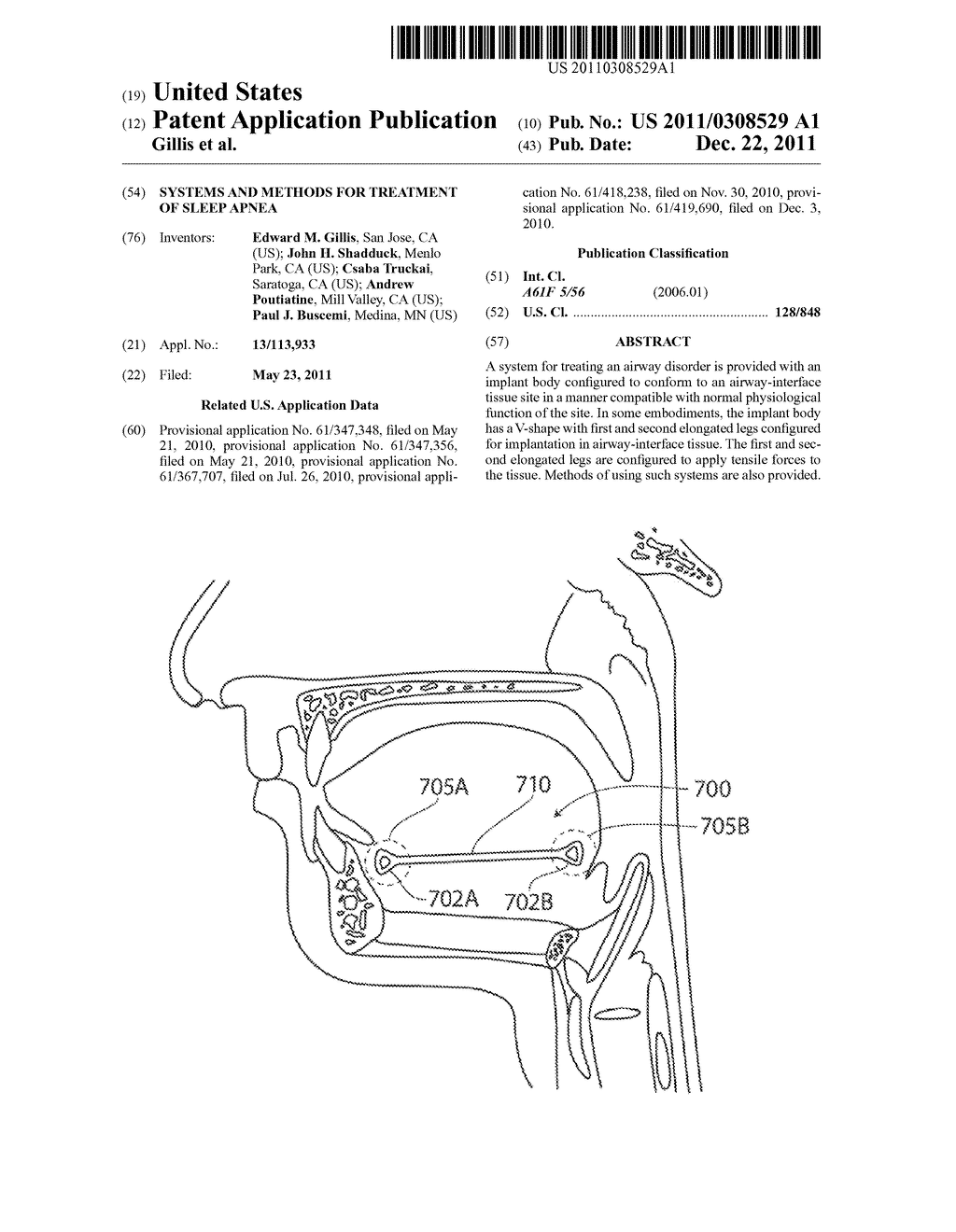 SYSTEMS AND METHODS FOR TREATMENT OF SLEEP APNEA - diagram, schematic, and image 01