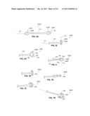 SYSTEMS AND METHODS FOR TREATMENT OF SLEEP APNEA diagram and image