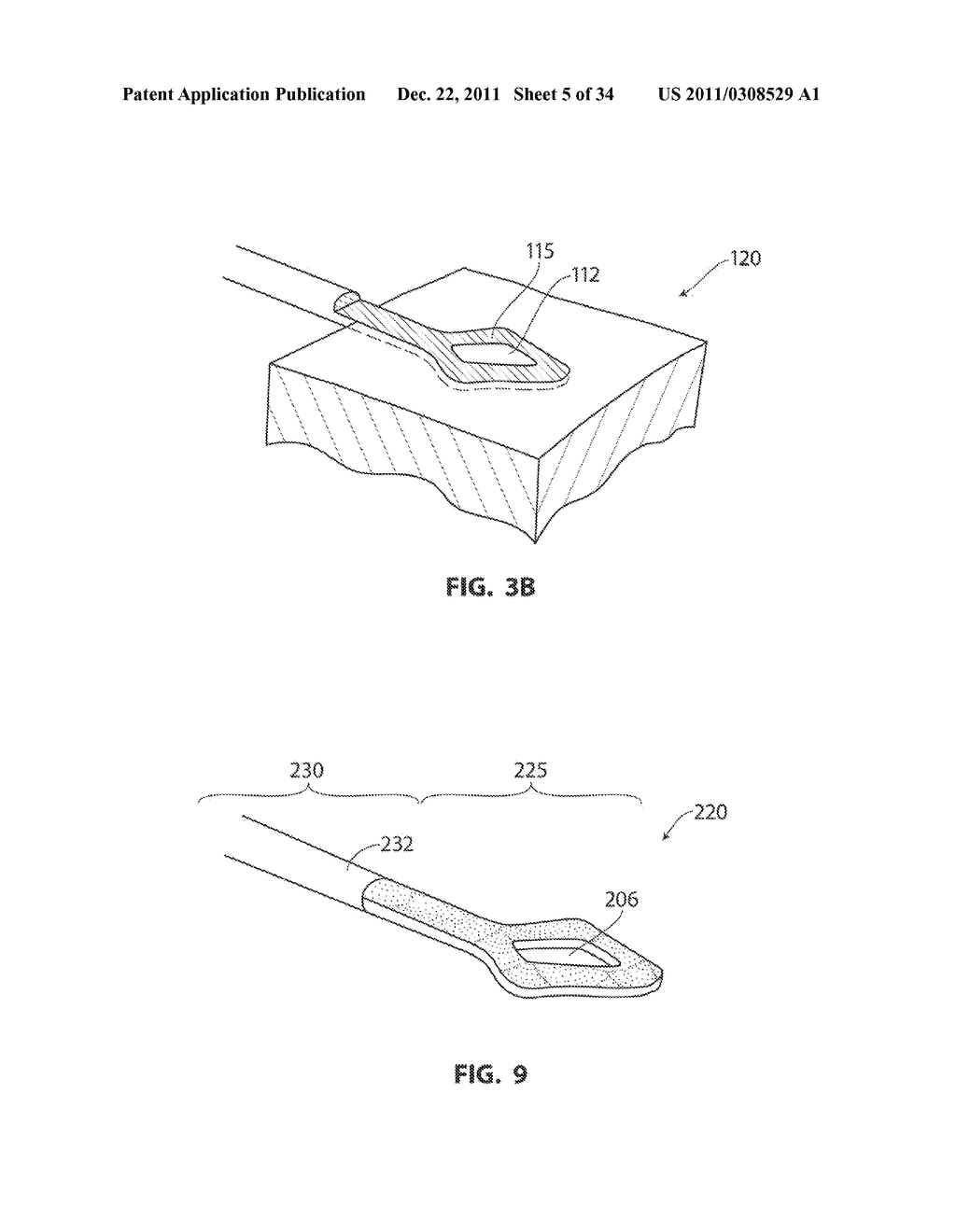 SYSTEMS AND METHODS FOR TREATMENT OF SLEEP APNEA - diagram, schematic, and image 06