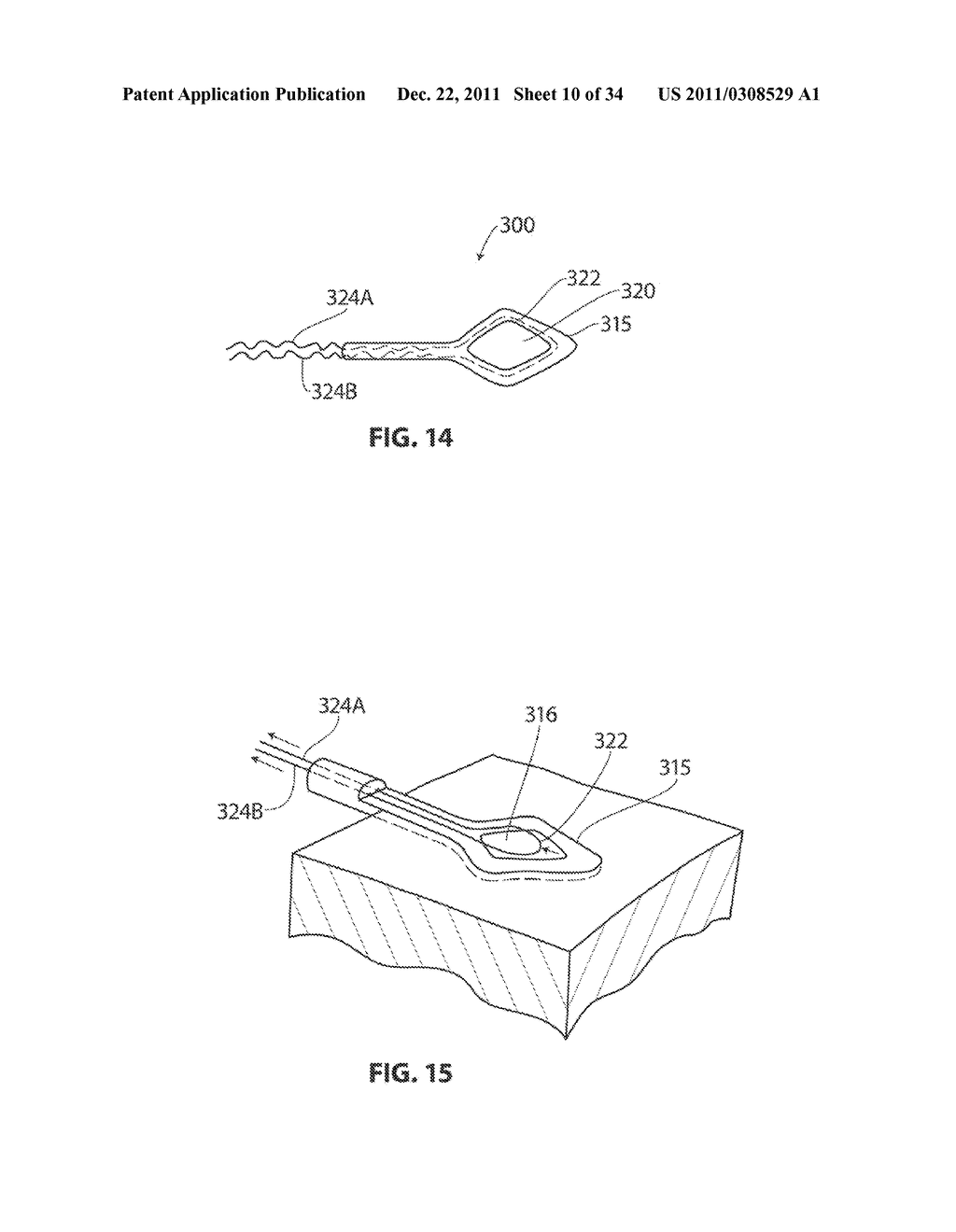 SYSTEMS AND METHODS FOR TREATMENT OF SLEEP APNEA - diagram, schematic, and image 11