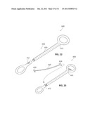 SYSTEMS AND METHODS FOR TREATMENT OF SLEEP APNEA diagram and image