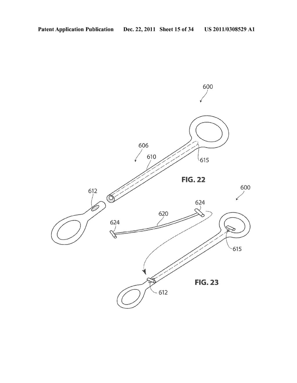 SYSTEMS AND METHODS FOR TREATMENT OF SLEEP APNEA - diagram, schematic, and image 16