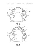 Apparatus for Clamping on the Lower or Upper Teeth, and Activator     Comprising Such an Apparatus diagram and image