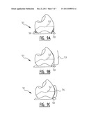 Apparatus for Clamping on the Lower or Upper Teeth, and Activator     Comprising Such an Apparatus diagram and image