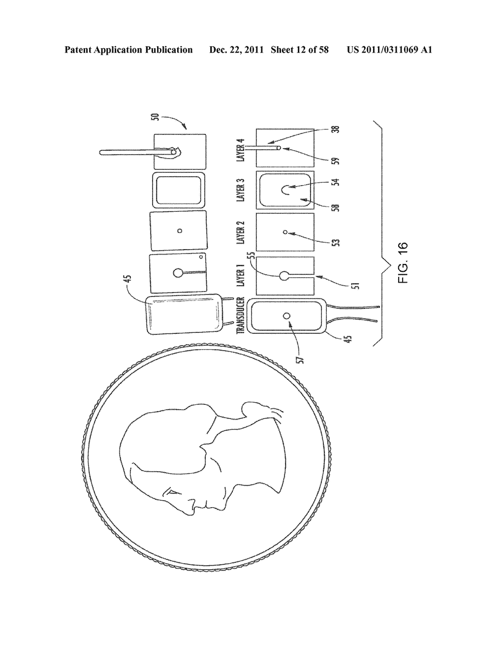 RECEIVER ASSEMBLY FOR AN INFLATABLE EAR DEVICE - diagram, schematic, and image 13