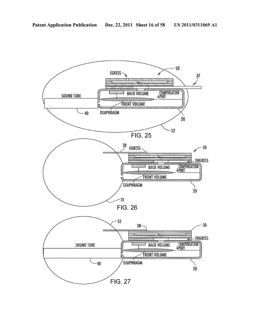 RECEIVER ASSEMBLY FOR AN INFLATABLE EAR DEVICE - diagram, schematic, and image 17