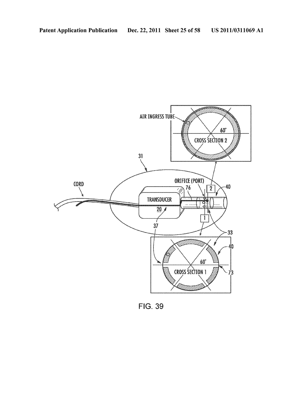 RECEIVER ASSEMBLY FOR AN INFLATABLE EAR DEVICE - diagram, schematic, and image 26