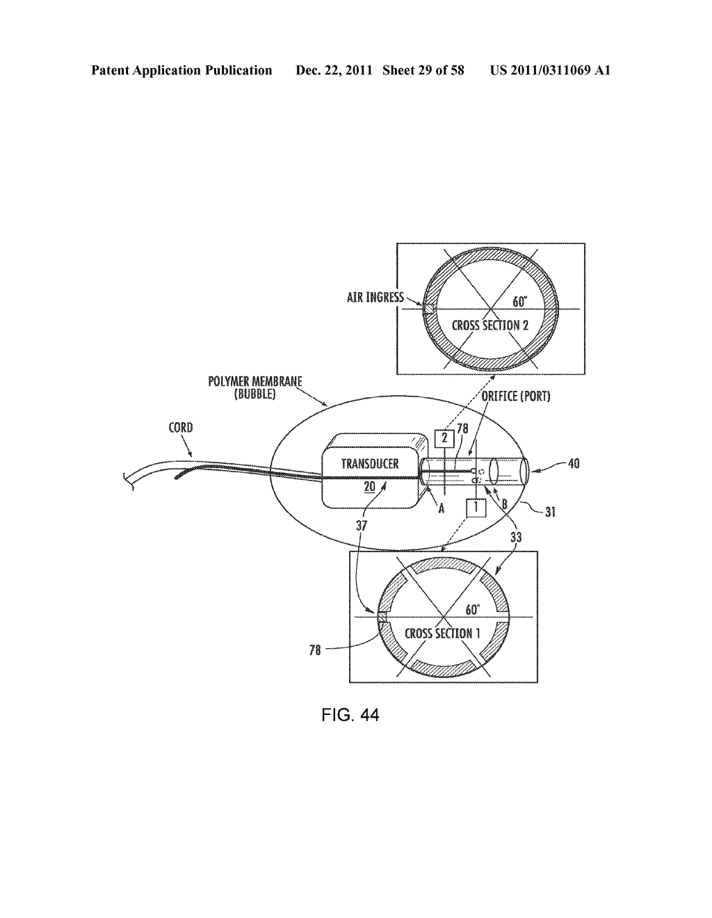 RECEIVER ASSEMBLY FOR AN INFLATABLE EAR DEVICE - diagram, schematic, and image 30