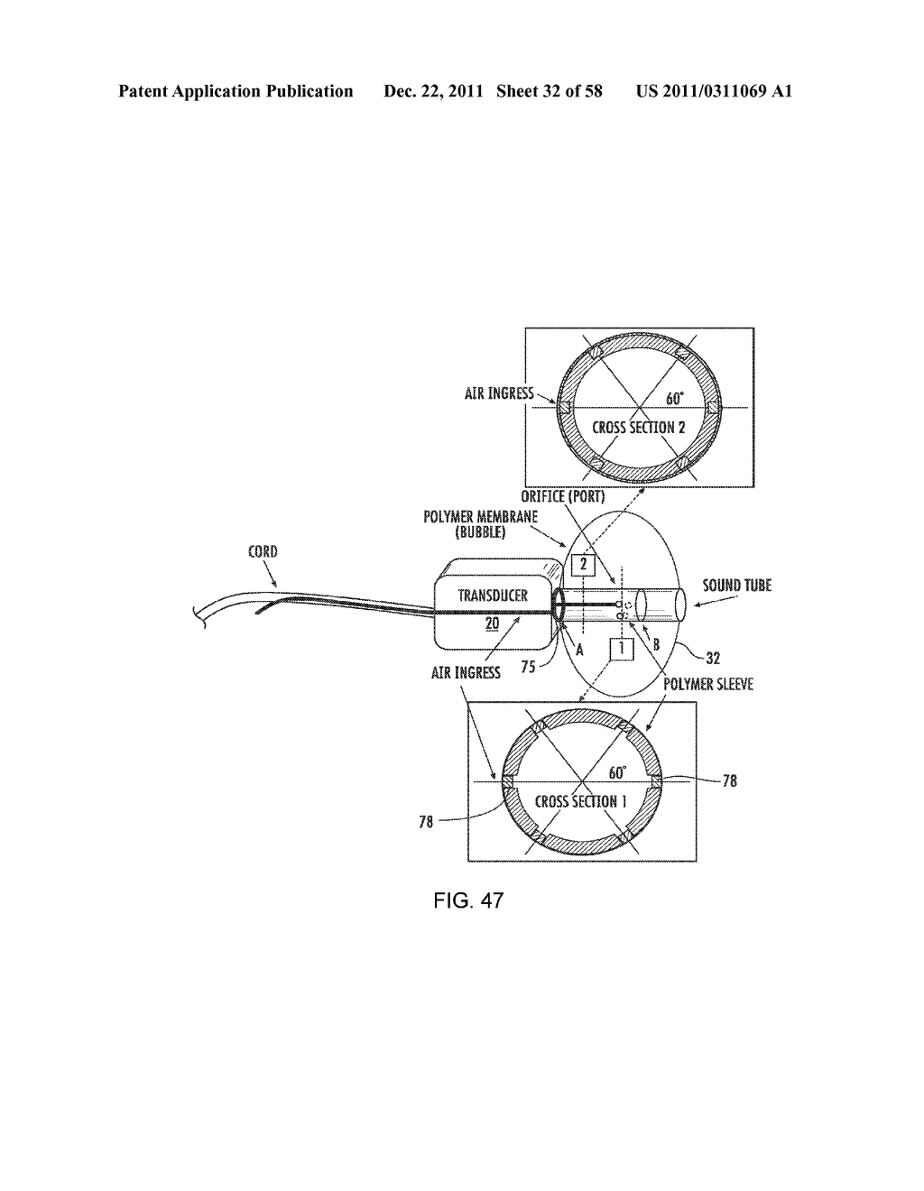 RECEIVER ASSEMBLY FOR AN INFLATABLE EAR DEVICE - diagram, schematic, and image 33