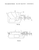 RECEIVER ASSEMBLY FOR AN INFLATABLE EAR DEVICE diagram and image