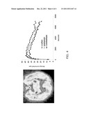 Compounds comprising 4-benzoylpiperidine as a Sigma-1-selective ligand diagram and image