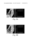 METHODS FOR IMAGING VASCULAR INFLAMMATION USING IMPROVED NANOPARTICLE     CONTRAST AGENTS diagram and image