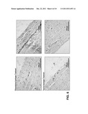 METHODS FOR STABILIZING A BIOPROSTHETIC TISSUE BY CHEMICAL MODIFICATION OF     ANTIGENIC CARBOHYDRATES diagram and image