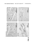 METHODS FOR STABILIZING A BIOPROSTHETIC TISSUE BY CHEMICAL MODIFICATION OF     ANTIGENIC CARBOHYDRATES diagram and image