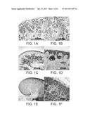 ISOLATED POPULATIONS OF RENAL STEM CELLS AND METHODS OF ISOLATING AND     USING SAME diagram and image