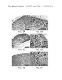 ISOLATED POPULATIONS OF RENAL STEM CELLS AND METHODS OF ISOLATING AND     USING SAME diagram and image