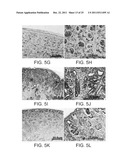 ISOLATED POPULATIONS OF RENAL STEM CELLS AND METHODS OF ISOLATING AND     USING SAME diagram and image