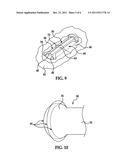 Bead-Stiffened Composite Parts diagram and image