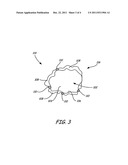 BORON-DOPED DIAMOND COATED CATALYST SUPPORT diagram and image