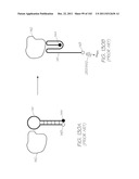 LOC DEVICE FOR PATHOGEN DETECTION, GENETIC ANALYSIS AND PROTEOMIC ANALYSIS     WITH DIALYSIS, CHEMICAL LYSIS, INCUBATION AND TANDEM NUCLEIC ACID     AMPLIFICATION diagram and image