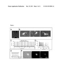 METHODS OF DIAGNOSING AND TREATING NEURODEGENERATIVE DISEASES diagram and image