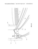 Systems, Apparatus and Methods of a Dome Retort diagram and image