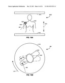 Multi-Field Charged Particle Cancer Therapy Method and Apparatus diagram and image