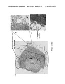 DOWN-REGULATION OF COLD SHOCK PROTEINS FOR CANCER TREATMENT diagram and image