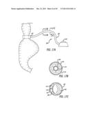 FLOW RESTRICTOR AND METHOD FOR AUTOMATICALLY CONTROLLING PRESSURE FOR A     GASTRIC BAND diagram and image