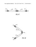 FLOW RESTRICTOR AND METHOD FOR AUTOMATICALLY CONTROLLING PRESSURE FOR A     GASTRIC BAND diagram and image