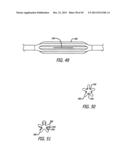 FLOW RESTRICTOR AND METHOD FOR AUTOMATICALLY CONTROLLING PRESSURE FOR A     GASTRIC BAND diagram and image