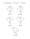 SYSTEM FOR TISSUE DISSECTION AND RETRACTION diagram and image