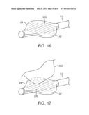 SYSTEM FOR TISSUE DISSECTION AND RETRACTION diagram and image