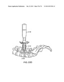 SURGICAL METHODS AND SURGICAL KITS diagram and image