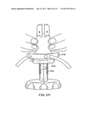 SURGICAL METHODS AND SURGICAL KITS diagram and image