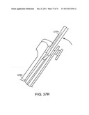 SURGICAL METHODS AND SURGICAL KITS diagram and image