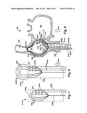 APPARATUS AND METHOD FOR TARGETING A BODY TISSUE diagram and image