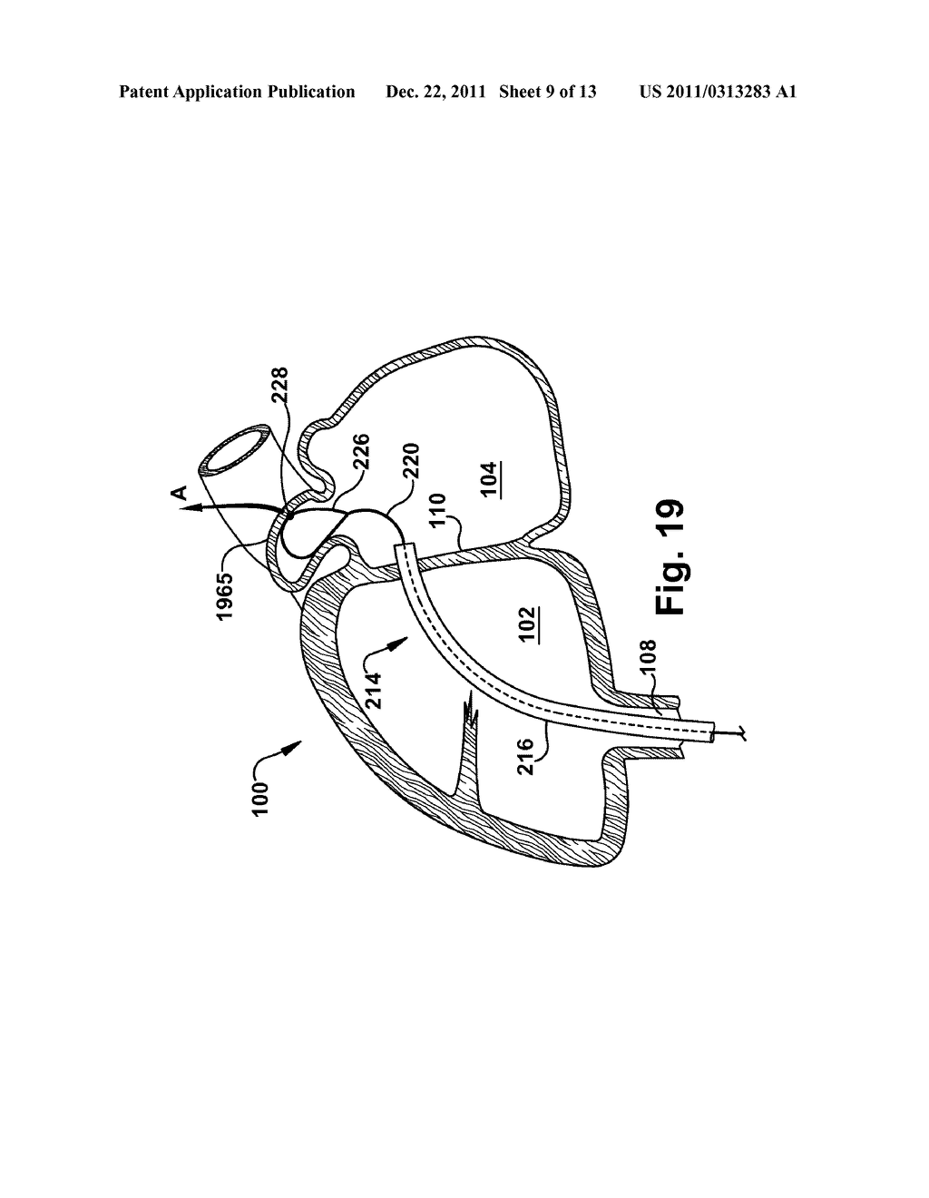 APPARATUS AND METHOD FOR TARGETING A BODY TISSUE - diagram, schematic, and image 10