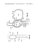 APPARATUS AND METHOD FOR TARGETING A BODY TISSUE diagram and image