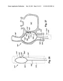 APPARATUS AND METHOD FOR TARGETING A BODY TISSUE diagram and image