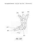 SYSTEMS AND METHODS TO REDUCE FLUID CONTAMINATION diagram and image