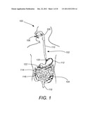 Device for Electrically and Mechanically Stimulating a Compartment in a     Body diagram and image