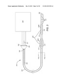 Device for Electrically and Mechanically Stimulating a Compartment in a     Body diagram and image