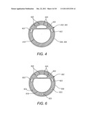 Device for Electrically and Mechanically Stimulating a Compartment in a     Body diagram and image